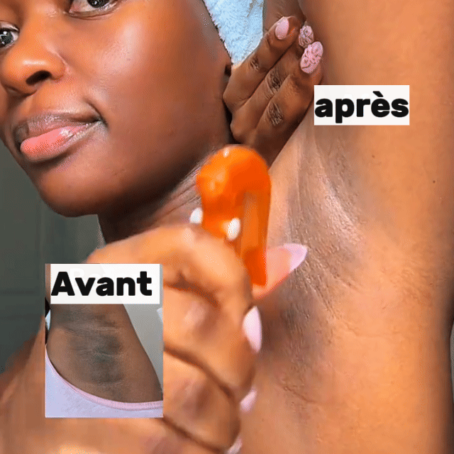 Dr. Melaxin – Spray Exfoliant de la Peau à l’Acide Kojique et au Curcuma