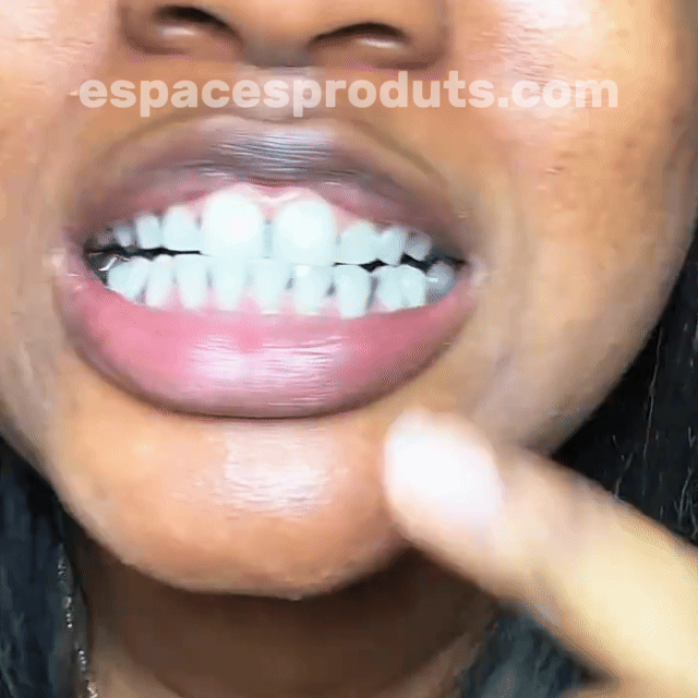 Bandes dentaires 🦷 Ultra-violet 🟣 (V34)